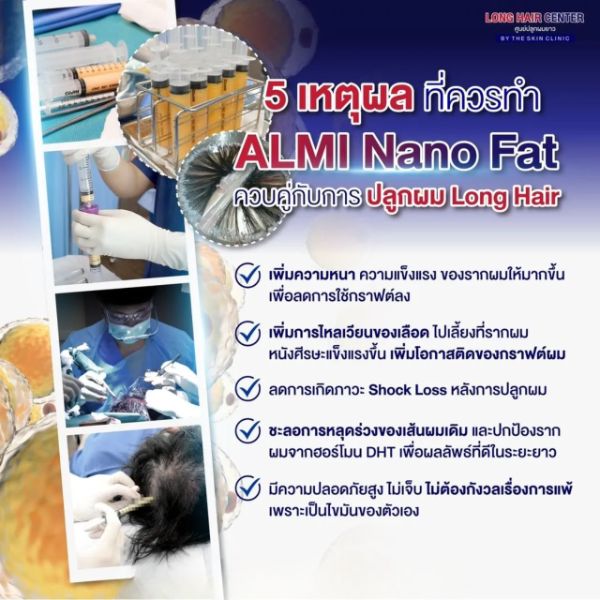 หมดปัญหาผมร่วง ผมบาง ศีรษะล้าน รักษาได้ที่ Dr.Top Hair Hospital by The Skin Clinic