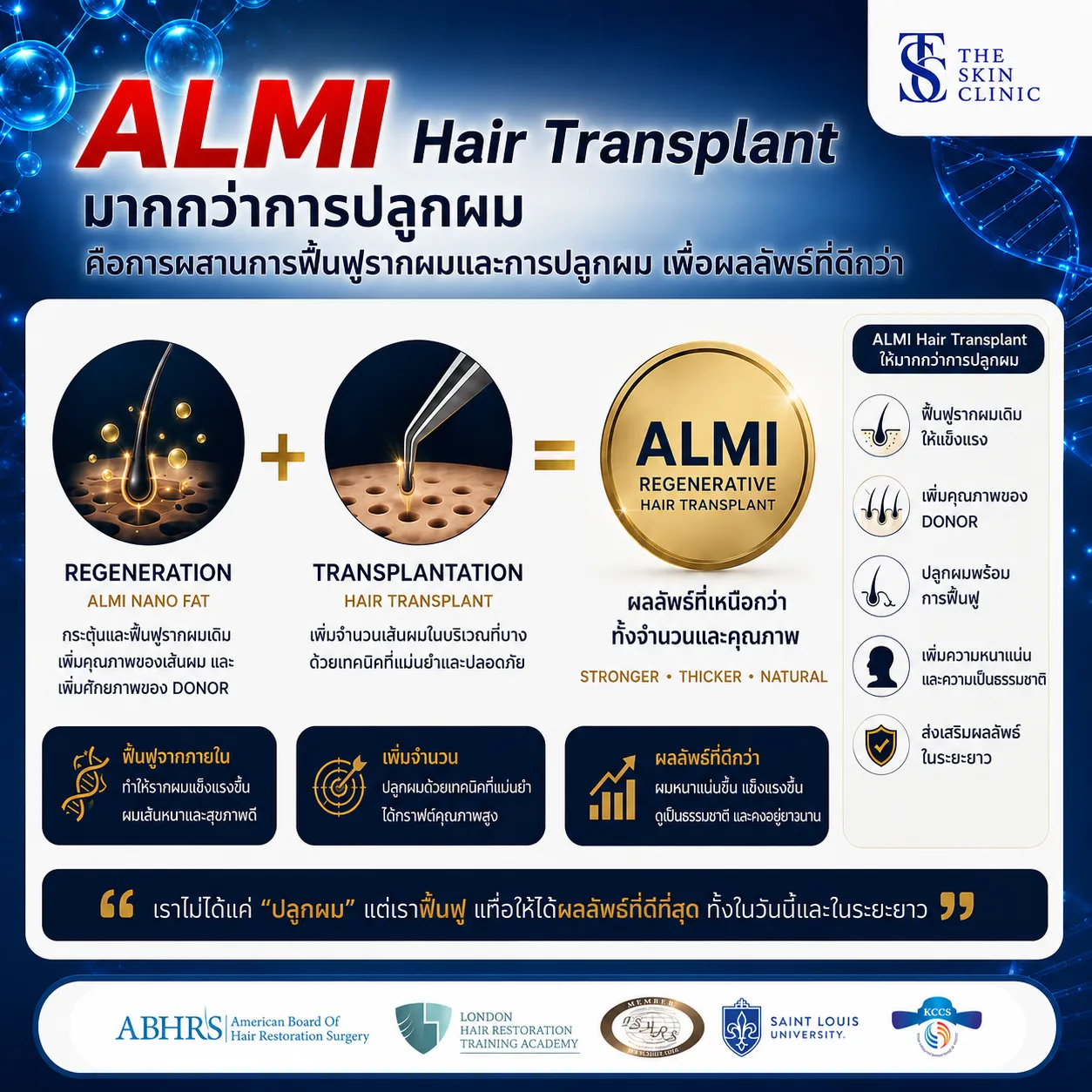 ปลูกผม FUI ที่ Dr.Top Hair Hospital คลินิกปลูกผม มาตรฐานระดับโรงพยาบาลปลูกผม