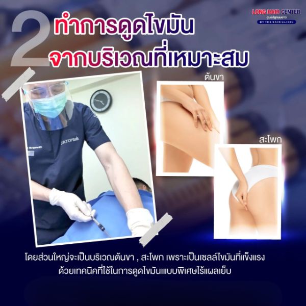 ALMI Nano fat ฟื้นฟูรากผม คลินิก ปลูกผม ทางเลือกใหม่ที่ปลอดภัย ไม่ต้องปลูกผม