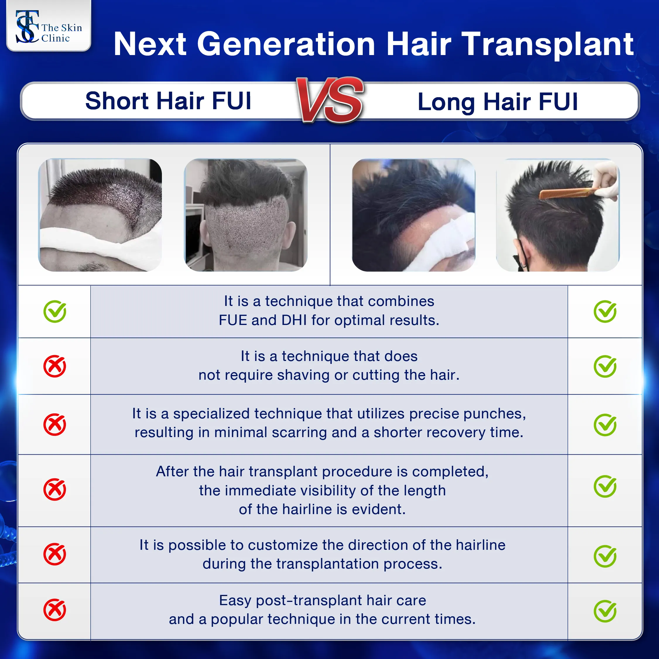 FUE Hair Transplant, Hair Regrowth, Hair Transplant Bangkok | THE SKIN CLINIC