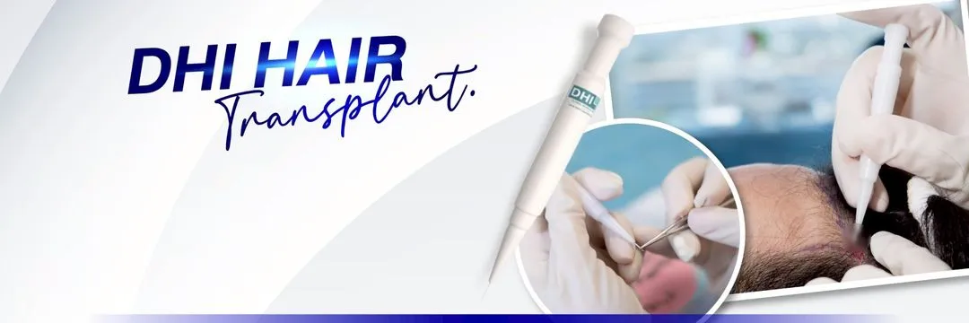 เทคนิคศัลยกรรมปลูกผม Direct Hair Implantation (DHI) ไร้รอยแผลเป็น