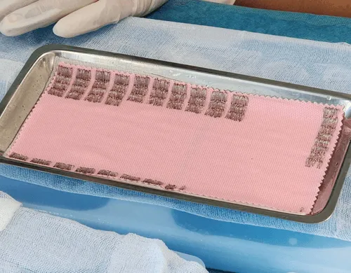 เจาะเก็บกราฟต์ผมจากด้านหลังใช้เครื่องมือหัวเจาะพิเศษขนาดเล็ก