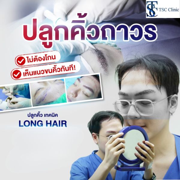ปลูกคิ้ว 3D Long Hair FUI ที่โรงพยาบาล ปลูกผม Dr.Top Hair Hospital
