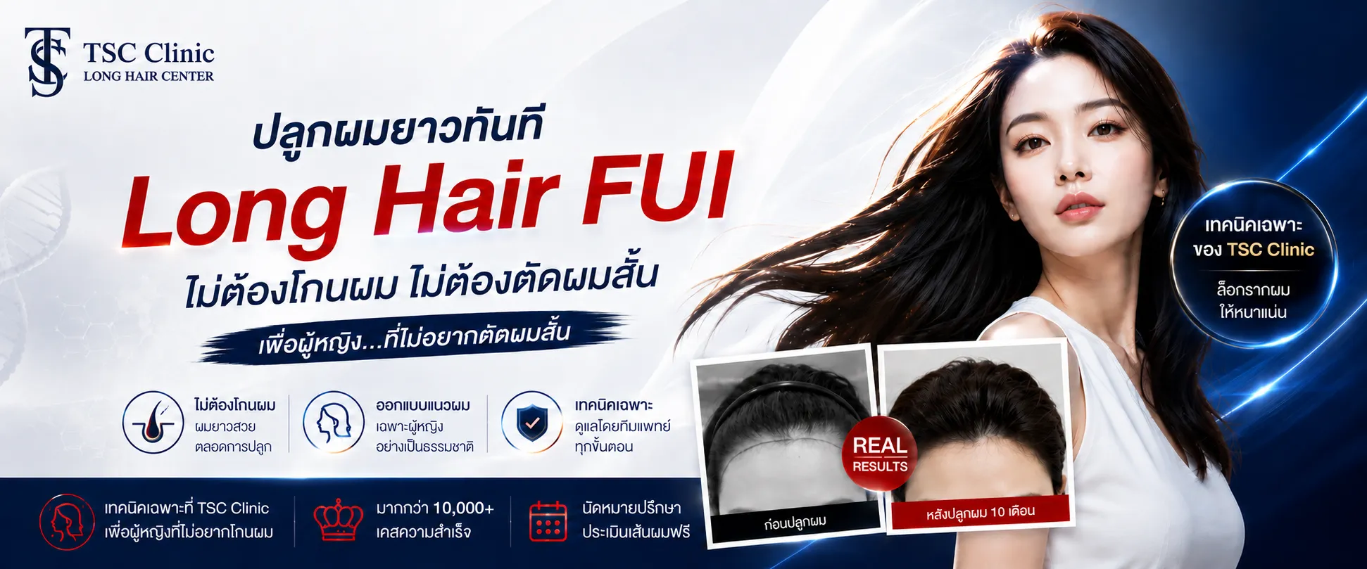 ปลูกผมผู้หญิง Long Hair FUI ที่โรงพยาบาลปลูกผม Dr.Top Hair Hospital