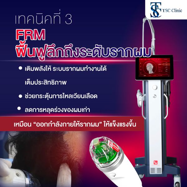 ทำไมต้อง FRM Anti Hair Loss ที่ Dr.Top Hair Hospital?