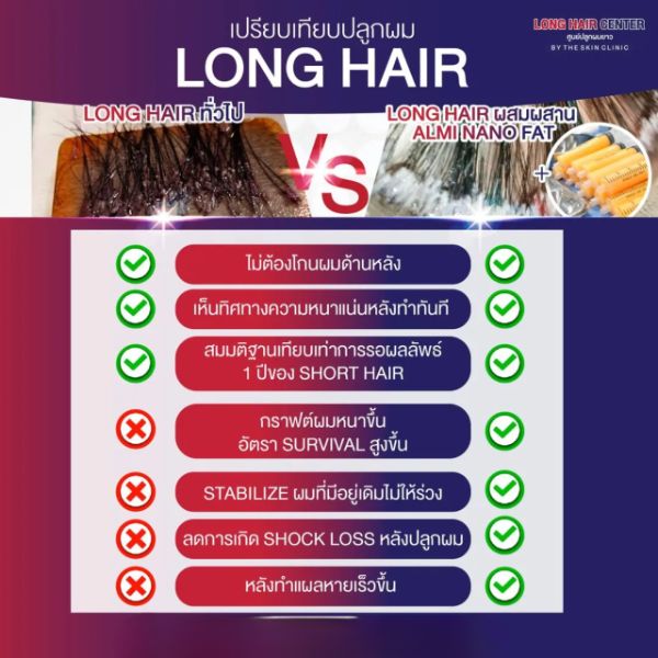 ALMI Nano fat ฟื้นฟูรากผม คลินิก ปลูกผม ทางเลือกใหม่ที่ปลอดภัย ไม่ต้องปลูกผม