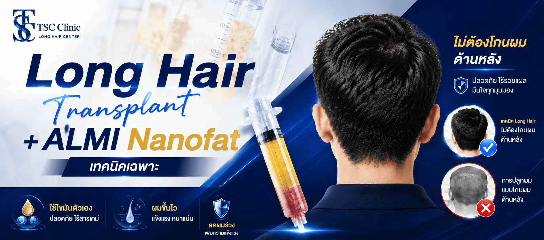 ปลูกผม FUI ที่ Dr.Top Hair Hospital คลินิกปลูกผม มาตรฐานระดับโรงพยาบาลปลูกผม