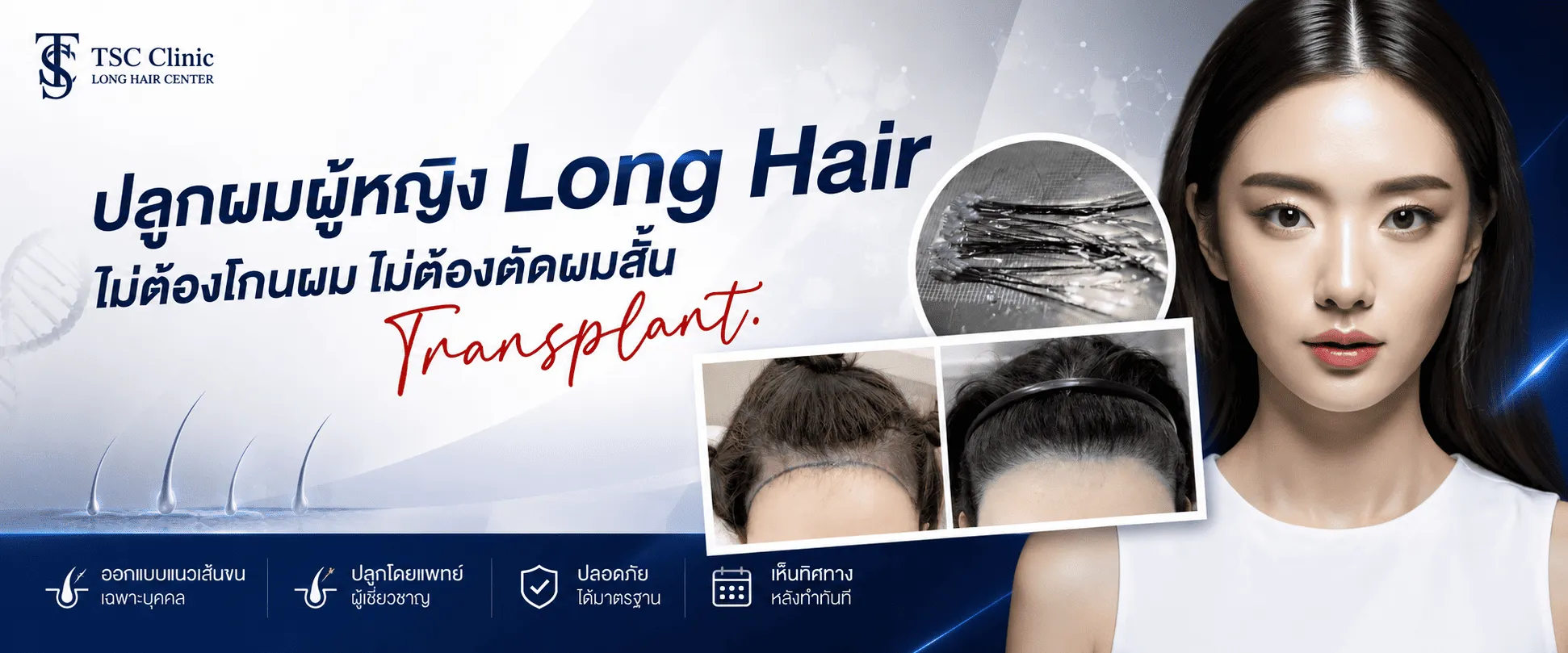 ปลูกผมผู้หญิง Long Hair FUI ที่โรงพยาบาลปลูกผม Dr.Top Hair Hospital