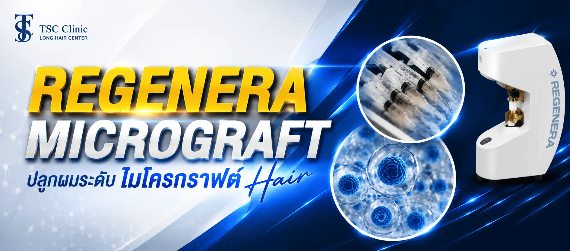 Regenera Micrograft Hair ปลูกผม ไมโครกราฟต์ ปลูกผมเทคโนโลยีทันสมัย โดยไม่ต้องปลูกย้ายรากผม