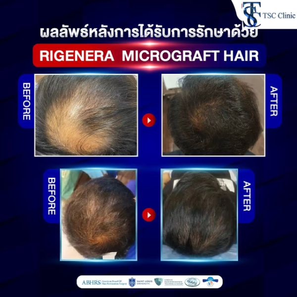 Rigenera เหมาะสำหรับใคร?