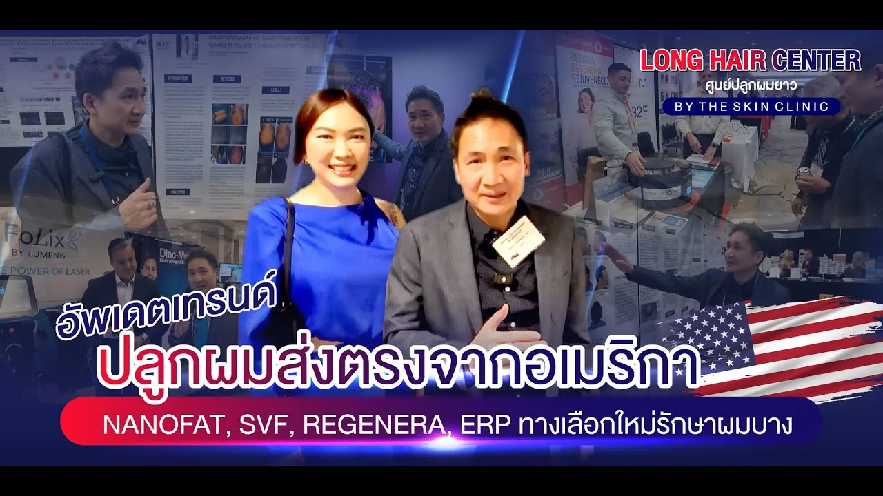 อัพเดตเทรนด์ปลูกผมส่งตรงจากอเมริกา ALMI Nanofat, SVF, Regenera, ERP ทางเลือกใหม่รักษาผมบาง