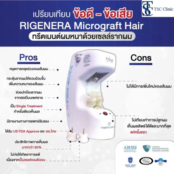 Hair Transplant, ศัลยกรรมปลูกผม