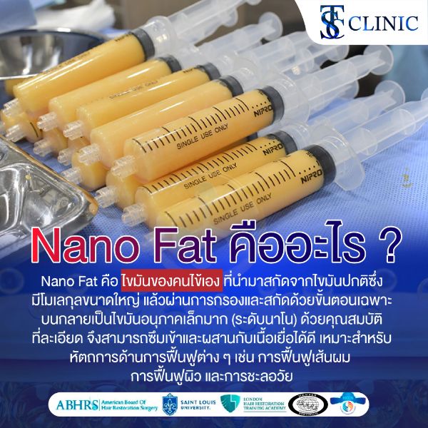 ALMI Nano fat ฟื้นฟูรากผม คลินิก ปลูกผม ทางเลือกใหม่ที่ปลอดภัย ไม่ต้องปลูกผม