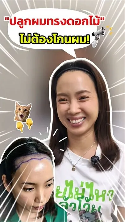ทีมแพทย์ปลูกผม The Skin Clinic
