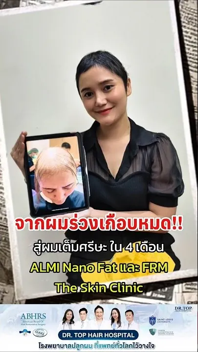 ทีมแพทย์ปลูกผม The Skin Clinic