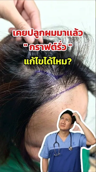 ทีมแพทย์ปลูกผม The Skin Clinic